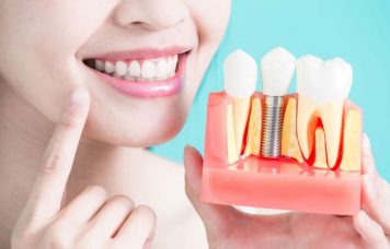 recuperare dupa implant dentar